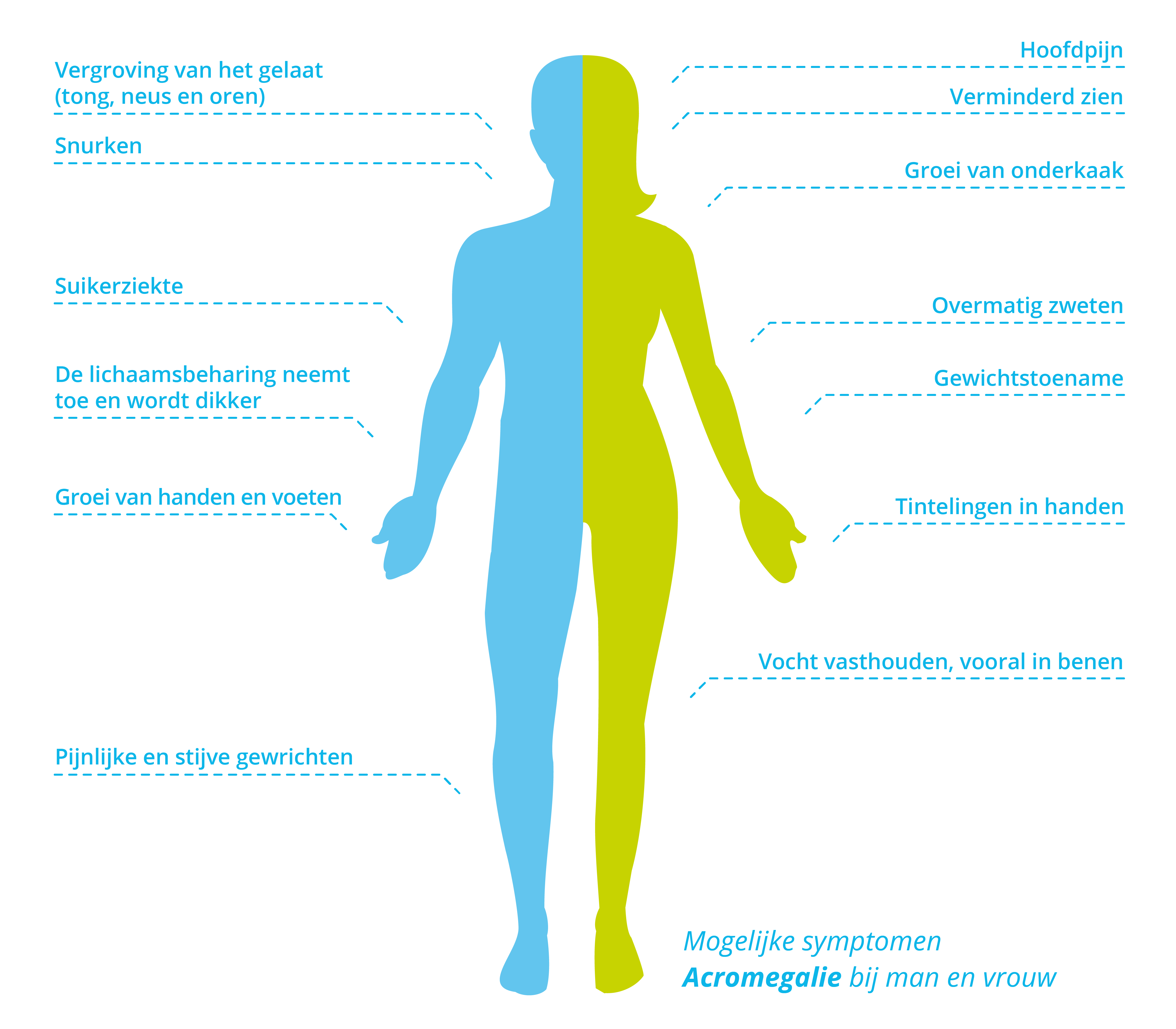 Symptomen acromegalie bij mannen en vrouwen